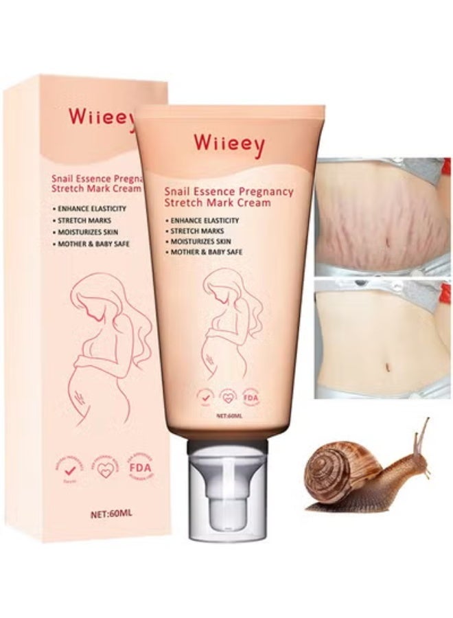 wiieey Snail Essence Pregnancy Stretch Mark Cream, Stretch Marks And Scar Removal Cream For Pregnancy, Stretch Marks Scar Belly Creams For Wrinkles, Obesity Fat Stretch Mark Moisturizing, Remove Marks - Image 1